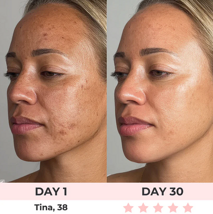 Vinora GlowMask